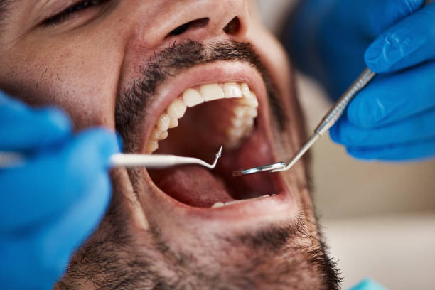 Best Emergency Tooth Extraction in Valley Hill, NC