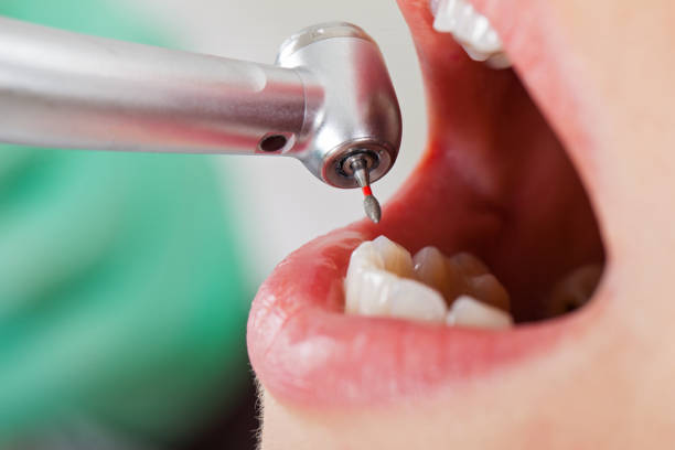 Best Emergency Tooth Extraction in Valley Hill, NC